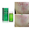 Тоник BREYLEE Acne Treatment Toner 100 мл для лечения акне кожи лица