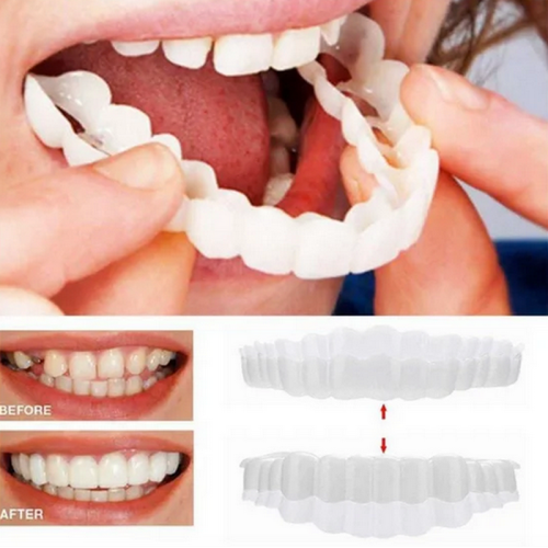 Съемные виниры на верхние и нижние челюсти Snap On Smile Veneers с кейсом