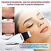 Ультразвуковий скрабер для очищенняя обличчя Ultrasonic Skin Scrubber С3