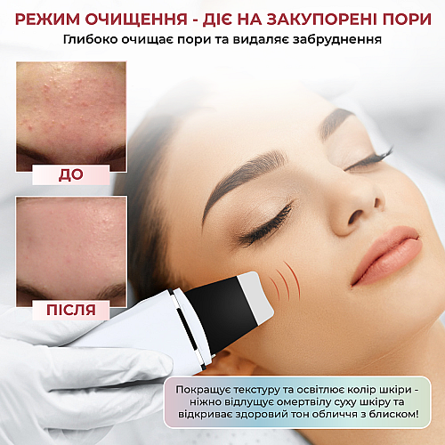 Ультразвуковий скрабер для очищенняя обличчя Ultrasonic Skin Scrubber С3