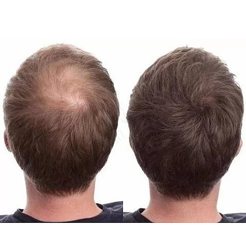 Загущувач для волосся пудра Toppik Hair Building Fibers каштановий medium brown 27. 5 г (mb-03)