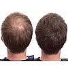 Загуститель для волос пудра Toppik Hair Building Fibers темно-русый light brown 27.5 г (lb-04)