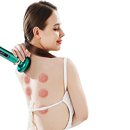 Антицелюлітний вакуумний масажер RIAS Cupping Massage Instrument з інфрачервоним нагріванням Green