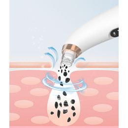 Аппарат для глубокой вакуумной чистки пор лица Profi Care X19 ( PCX19 )