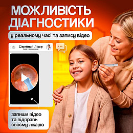 Прибор для удаления ушной серы с камерой Brillix 1296P Белый (PO-White)