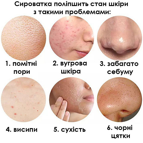 Сироватка для обличчя Sersanlove Cactus Essence 30 мл
