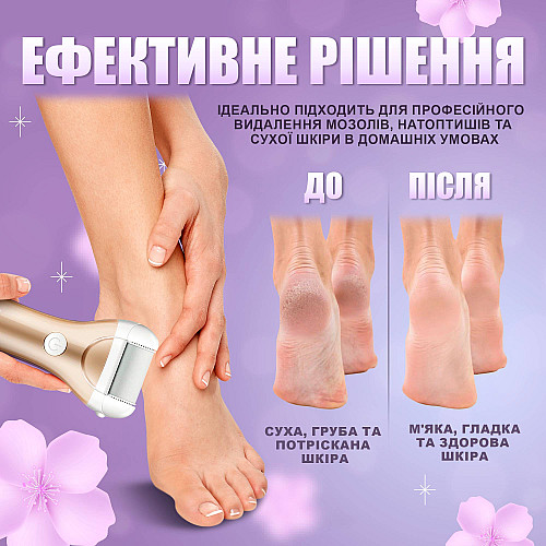 Електрична роликова пилка-пемза No Brand з функцією самоочищення та акумулятором Золото