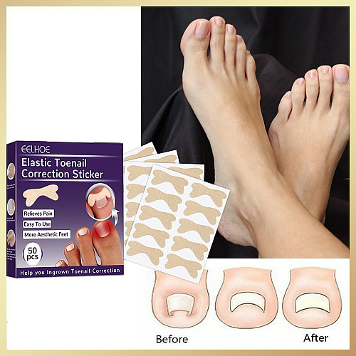 Набір для корекції вростаючих нігтів Elastic Toenail Correction Sticker 50 шт Бежевий (2104618421)