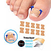 Набір для корекції вростаючих нігтів Elastic Toenail Correction Sticker 50 шт Бежевий (2104618421)