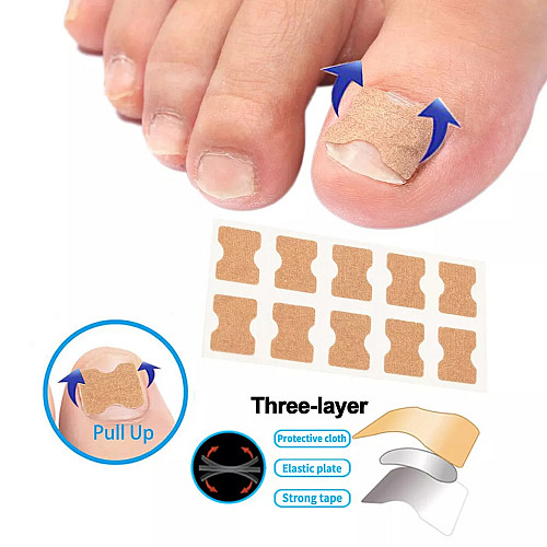 Набір для корекції вростаючих нігтів Elastic Toenail Correction Sticker 50 шт Бежевий (2104618421)