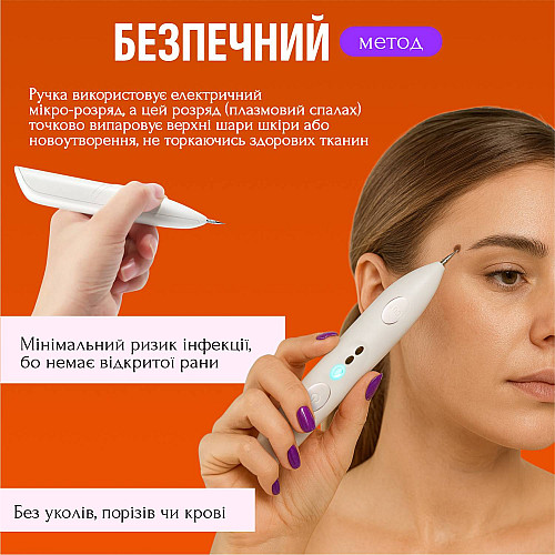 Электрокоагулятор плазменный для удаления папиллом бородавок No Brand Mini Freckle Белый (MF-Pen)