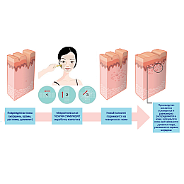 Мезороллер для лица AIW 75 Skin Roller System 540 игл длина иглы 75 мм Black (vol-55)