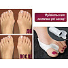 Лечебный фиксатор большого пальца Valgus Pro Medicus (Вальгус Про) - пара, для коррекции косточки