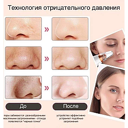 Аппарат для чистки пор вакуумный UKC MULTI-FUNCTIONAL CLEANING White (14966-hbr)