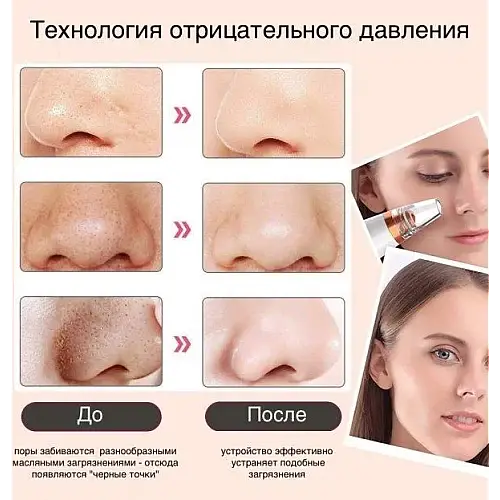 Аппарат для чистки пор вакуумный UKC MULTI-FUNCTIONAL CLEANING White (14966-hbr)